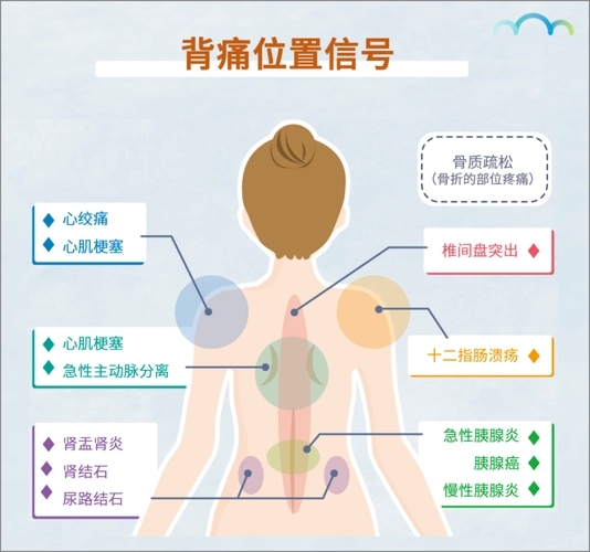 后背疼痛位置图详解图片，胆囊炎/肾结石/颈椎病（结合疼痛位置