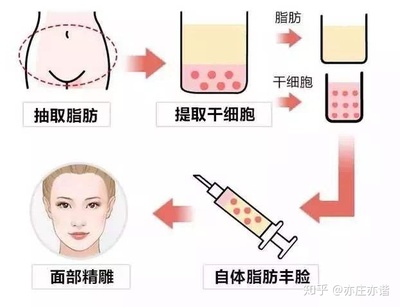 眼围胶原蛋白多少钱,法令印胶原蛋白多少钱